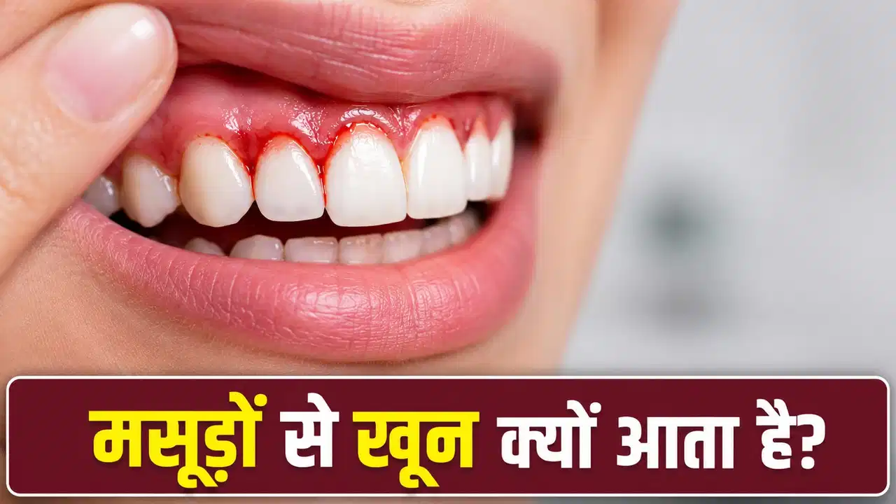 Gum Disease: Bleeding gums could be a sign of a serious illness! Find out when you should see a doctor immediately.